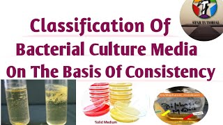 Classification Of Bacterial Culture Media on the basis of Consistency ll Microbiology [upl. by Eleahcim557]