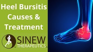 Heel Bursitis Causes and Treatment [upl. by Garv243]