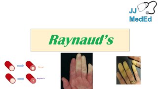 Introduction to Raynaud’s Phenomenon Syndrome  Pathophysiology Triggers Symptoms Treatment [upl. by Ahsile986]