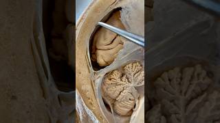 Incredible Tissue Surrounding Your Brain  Institute of Human Anatomy [upl. by Norrahc]