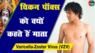 Chickenpox  Monkeypox  Eccgema  Psoriasis  Herpes  Urticaria चिकनपॉक्स Health [upl. by Heman]