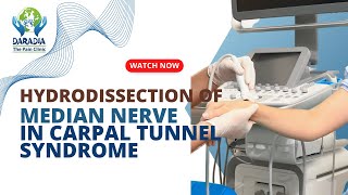 Hydrodissection of the Median Nerve and Fenestration of Flexor Retinaculum in Carpal Tunnel Syndrome [upl. by Aria]