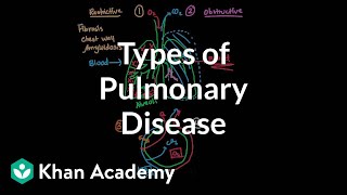 Types of pulmonary diseases  Respiratory system diseases  NCLEXRN  Khan Academy [upl. by Chancellor]