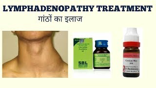 LYMPHADENOPATHY TREATMENTगांठों का ईलाज [upl. by Waldner133]