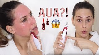 MICRONEEDLING FÜR ANFÄNGER  DERMAPEN TUTORIAL ANLEITUNG  KathisFinest [upl. by Anera]