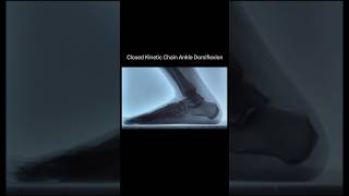 Closed Kinetic Chain Ankle Dorsiflexion via Dynamic XRay anatomy radiology [upl. by Paula]