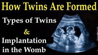 Twin Pregnancy Week By Week  EP01  Week 1 to 4  How Twins Are Formed During Pregnancy [upl. by Narruc]