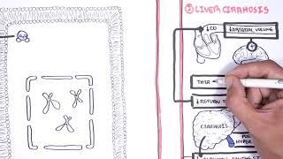 Hyponatraemia Hyponatremia  classification causes pathophysiology treatment [upl. by Tdnaltroc]