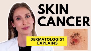 Skin Cancer Different Types Causes Prevention amp Treatments  Dr Sam Ellis [upl. by Anecuza]