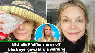 News Michelle Pfeiffer shows off black eye gives fans a warning SUNews [upl. by Norse575]