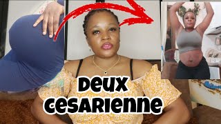 COMMENT AVOIR UN VENTRE PLAT APRES DEUX CESARIENNE 🤰🏾🤱🏾 [upl. by Willner]