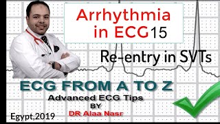 ECG from A to Z intermediate level Arrhythmia 15 Dr Alaa Nasr 2019 [upl. by Enirak850]