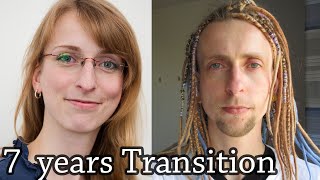 7Jahre FtM Transition Zeitraffer [upl. by Ime744]