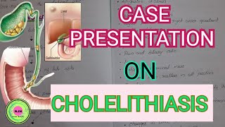 Case Presentation On Cholelithiasis OR Gallstone Medical Surgical Case Surgical Case Presentatio [upl. by Tengler]