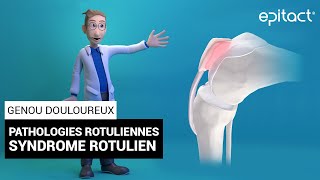 Syndrome Rotulien  Explication  EPITACT [upl. by Atteloiv]