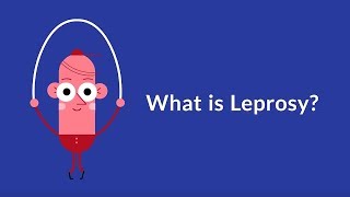 What is Leprosy Chronic Infectious Disease [upl. by Teirrah]