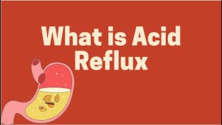 Hindi Heartburn ya Acid reflux kaise hota hai [upl. by Nalac]