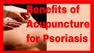 Acupuncture for Psoriasis [upl. by Eca]