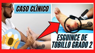 Rehabilitación ESGUINCE DE TOBILLO Grado 2 CASO CLÍNICO  MAL CURADO 🤯  TRATAMIENTO VENDAJE [upl. by Caro638]