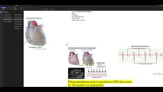 Oncological Emergencies Screen Recording 2023 10 27 at 3 15 20 PM [upl. by Nnalatsyrc]