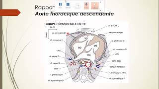 7  Aorte et Artère pulmonaire 6 [upl. by Auginahs]