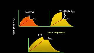 Ventilator Waveform Analysis [upl. by Sven]