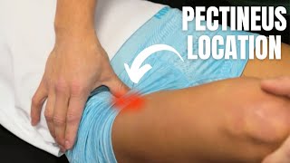 Pectineus Muscle Strain Location  Anterior Hip Pain Running [upl. by Elisee550]