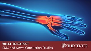 What to Expect During Nerve Conduction Studies and EMG Tests [upl. by Namwen]