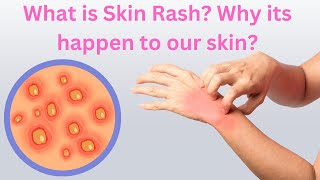 What is Skin Rash Why its happen to our skin  Med About You [upl. by Botnick]