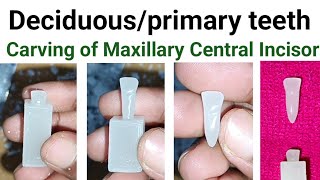 Carving of Primary Maxillary Central Incisor  Carving of Deciduous Maxillary Central Incisor [upl. by Brey]