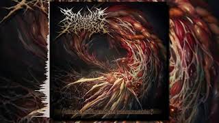 Sparganum Proliferum  Parasitic Mutated Infecting Of Human Beings Full Album [upl. by Lytsirk]