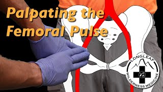 Palpating the Femoral Pulse [upl. by Rafter394]