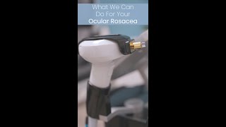 Do You Have Rosacea [upl. by Asiilanna]