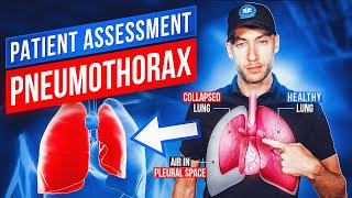 Patient Assessment Trauma  Tension Pneumothorax  EMT Skills  NREMT Review [upl. by Gyasi]