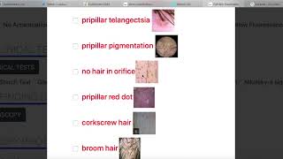 Full Examination skin and hair with all lesions description photos choices good for who start clinic [upl. by Ennasor]