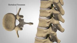 Myelopathy  Patient Education [upl. by Toffey]