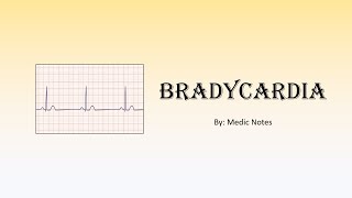 Bradycardia  causes mechanism and pathophysiology sign value [upl. by Shane591]