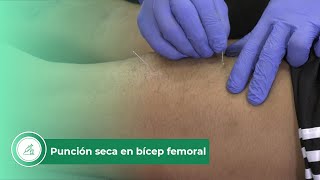 Punción seca en bícep femoral [upl. by Oedama144]