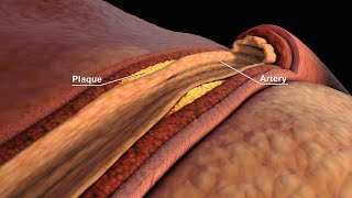 LDL and HDL Cholesterol  Good and Bad Cholesterol  Nucleus Health [upl. by Nahgiem]