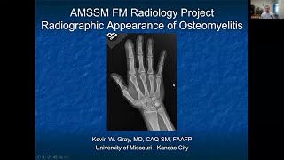 Osteomyelitis  MSK Radiology XRay Educational Modules for Primary Care Residents [upl. by Aneloj]