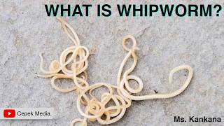 What is Whipworm  Biotechnology  General Medicine [upl. by Thibault21]