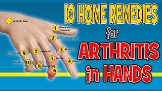 10 Home Remedies for Arthritis in Hands  Pain Relief Diet [upl. by Latty]