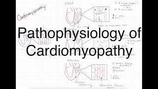 Pathophysiology of Cardiomyopathy [upl. by Ainehs535]