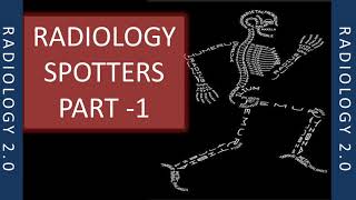 RADIOLOGY SPOTTERS RADIOLOGY 20 PART 1 XRAY [upl. by Jecon]