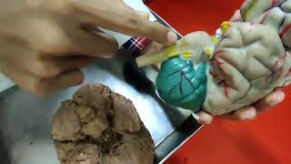 Cerebrum Viscera Bangla Demonstration  Brain Anatomy Bangla  Base Of The Brain [upl. by Gershom]