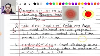 CSF rhinorrhea  causes symptoms Signs diagnosis treatment [upl. by Alain]