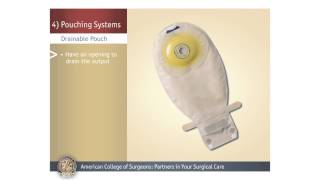 ColostomyIleostomy Pouching Systems [upl. by Rovner]