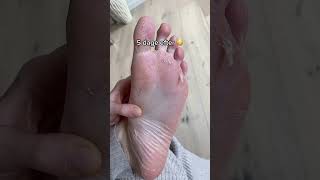 Foot Peeling Mask by Masque Me Up [upl. by Rossi39]