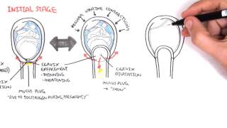 Obstetrics  Stage I of Labour [upl. by Kabob]