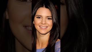 All Plastic Surgeries Of Kendall Jenner [upl. by Swinton]